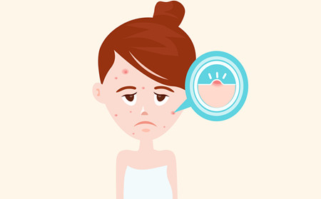 潍坊治疗痘痘皮肤病医院