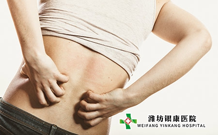 潍坊银康谈哪些因素会导致牛皮癣的发生
