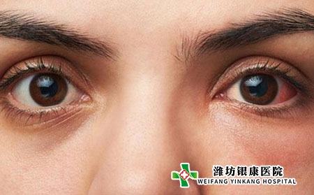 什么是痤疮?男性长青春痘的原因有哪些?
