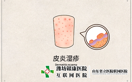 湿疹传染吗