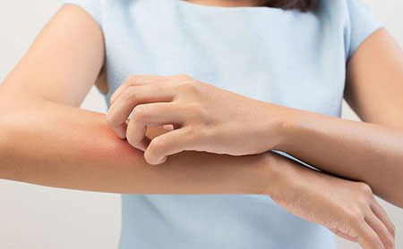 怎样治疗面部牛皮癣【潍坊银康医院评价好】 怎样治疗面部牛皮癣【潍坊银康医院评价好】