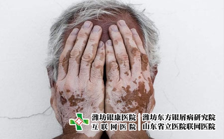 白癜风难治疗的原因有哪些呢?白癜风能治好吗
