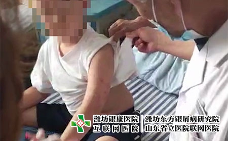 山东潍坊银屑病医院地址电话-潍坊银屑病那里好