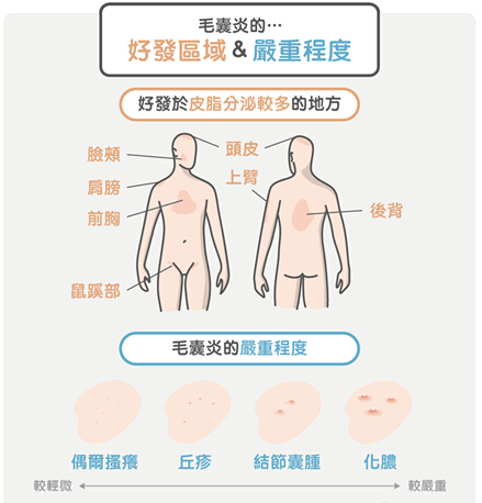 潍坊皮肤病医院治疗毛囊炎怎么样