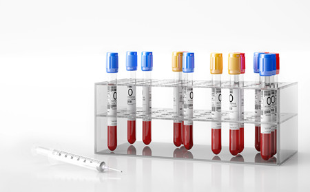 潍坊银屑病治疗,银屑病治疗好方法