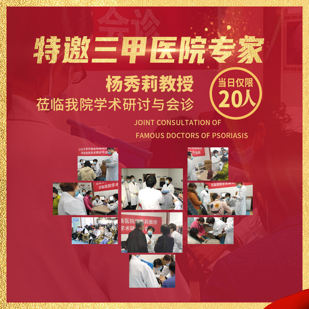 潍坊银康银屑病医院会诊