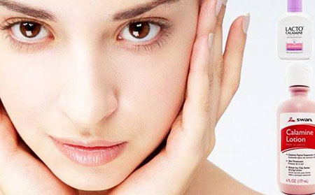 炉甘石洗剂治疗荨麻疹