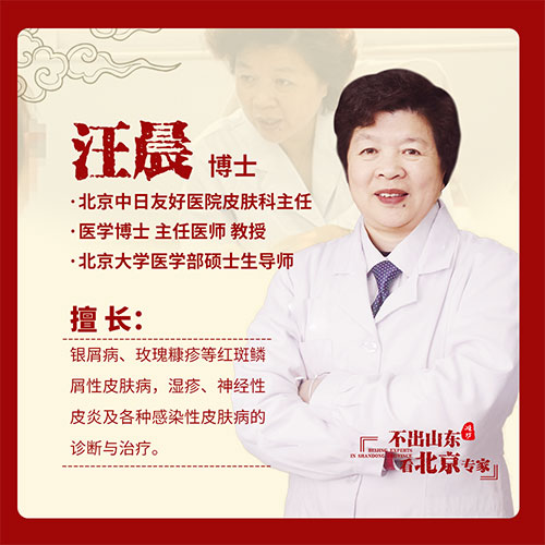 京鲁银屑病专家汪晨