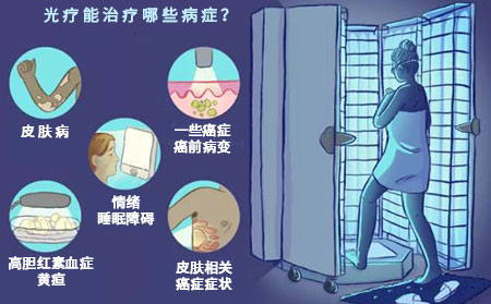 光疗历史及新生儿使用光疗效果和能治疗哪些皮肤癣病