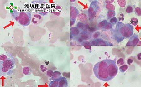 潍坊市皮肤病医院潍坊银康