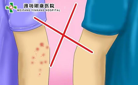 潍坊银康医院_疥疮预防