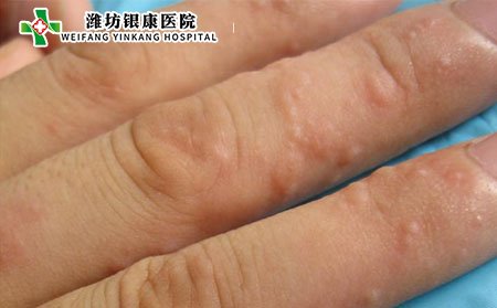 夏季皮肤瘙痒,为什么夏季皮肤瘙痒
