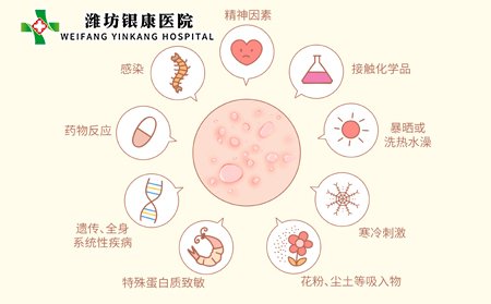 导致荨麻疹引起的原因是什么