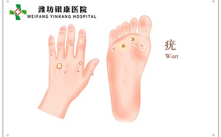 扁平疣常出现在面部、手足部位