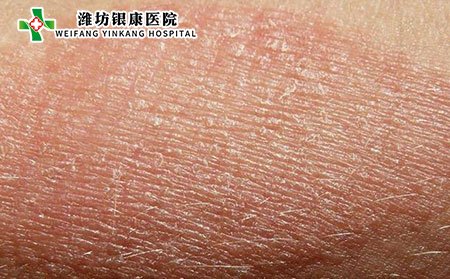 过敏性皮疹图片什么样子