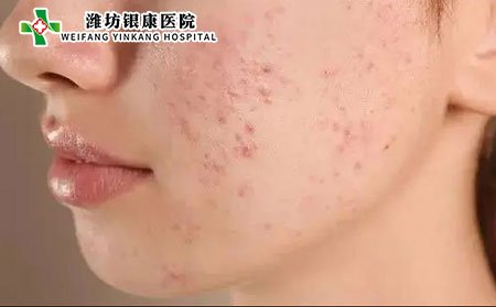过敏性皮疹的症状表现