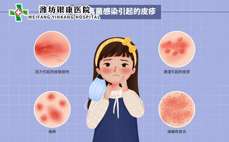 皮肤真菌感染引发的皮疹因素