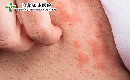 皮炎湿疹的并发症_皮炎湿疹的危害_皮炎湿疹的不良影响
