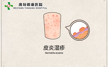 什么是皮炎湿疹_皮炎湿疹症状图片_皮炎湿疹长什么样