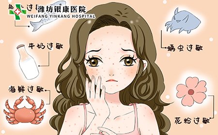 过敏是荨麻疹的主要原因