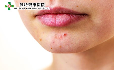 丘疹图片,丘疹症状