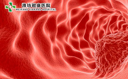 囊肿图片,囊肿症状