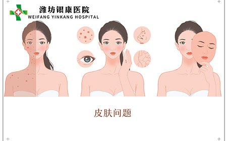 皮肤癣图片,皮肤癣类别,皮肤癣症状,皮肤癣照片