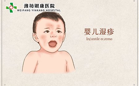 婴儿湿疹是什么原因引起的怎么引起的