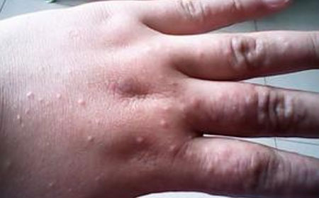 潍坊市哪家医院看皮肤病好一点