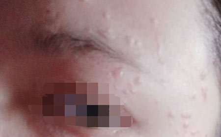 潍坊看皮肤病哪个医院好