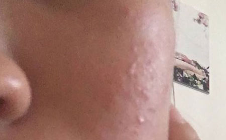 潍坊皮肤科医院哪家好