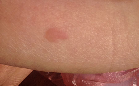 潍坊治疗皮肤病的医院