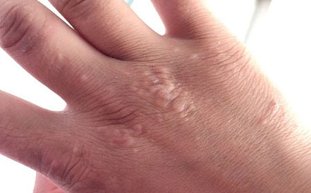 潍坊哪些是看皮肤病的正规医院