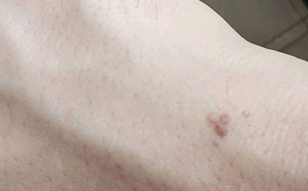 治疗皮肤病潍坊哪家医院好