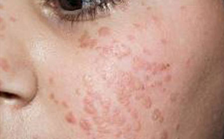 潍坊皮肤病哪家医院好