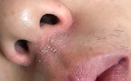 潍坊银康医院看的怎么样